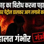 raipur-mana-chhedkhani-petrol-attack-girl-burned